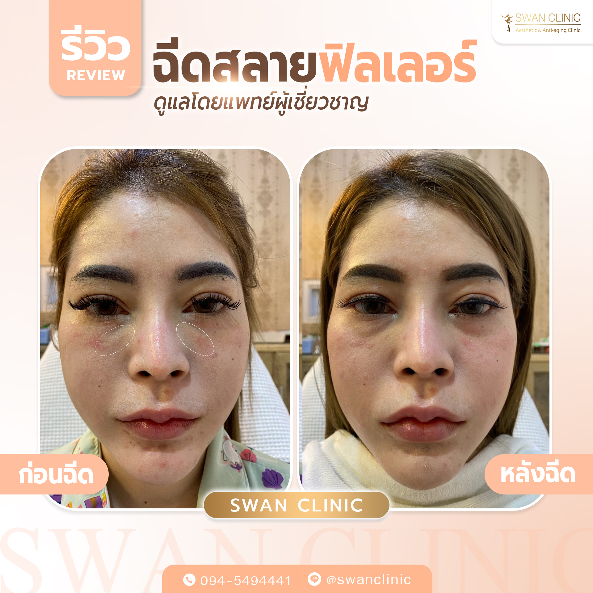 Swan Clinic review 1