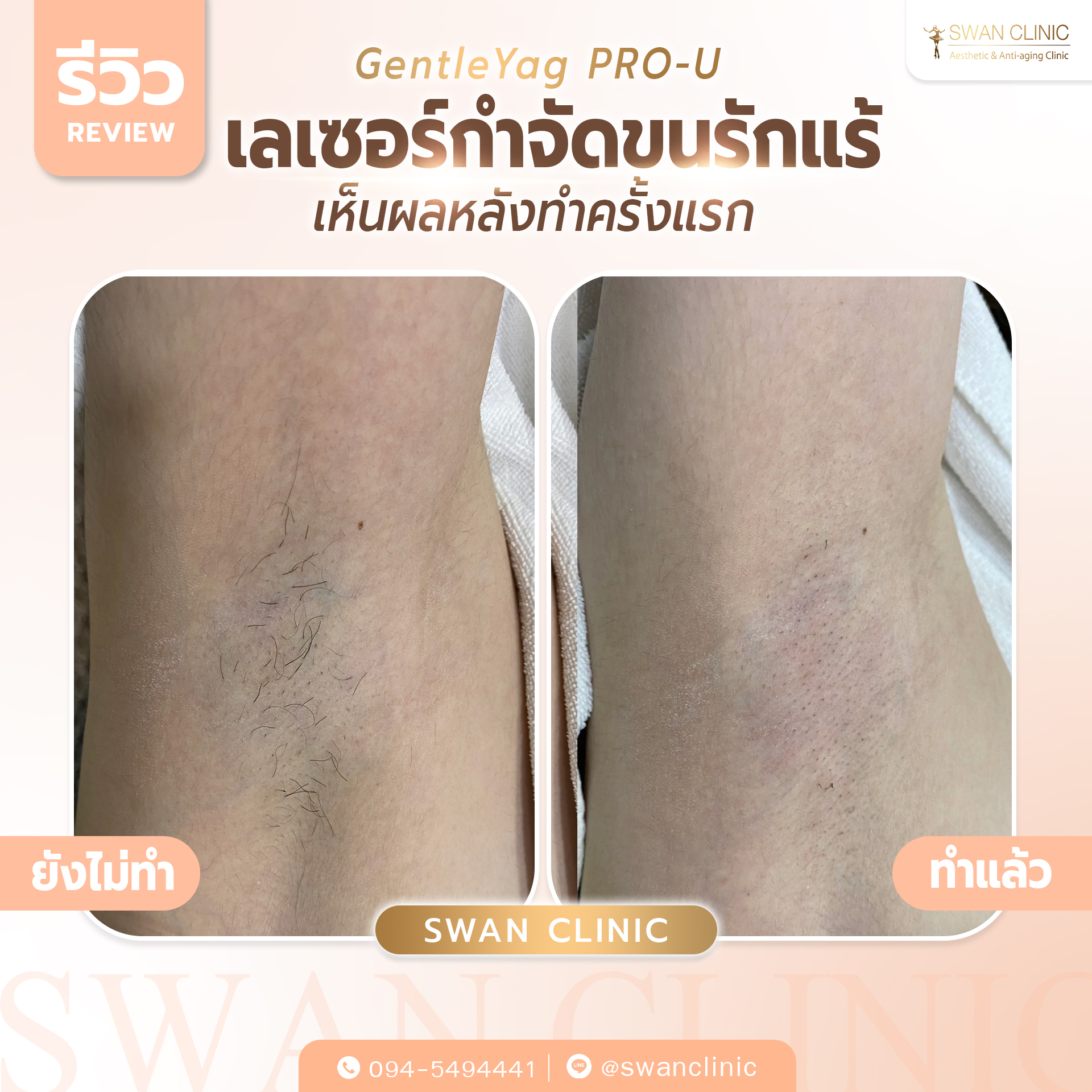 Swan Clinic review 3