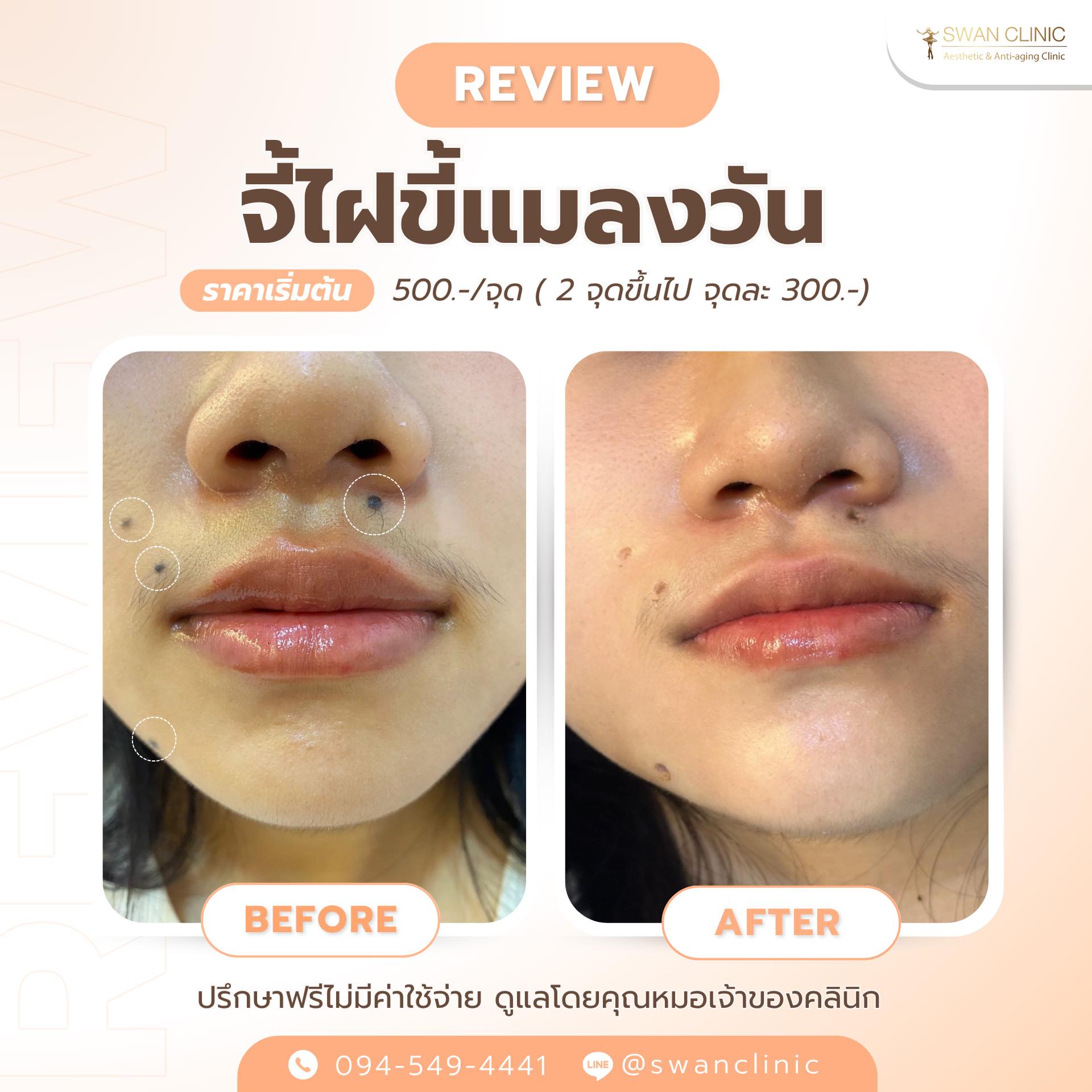 Swan Clinic review 9