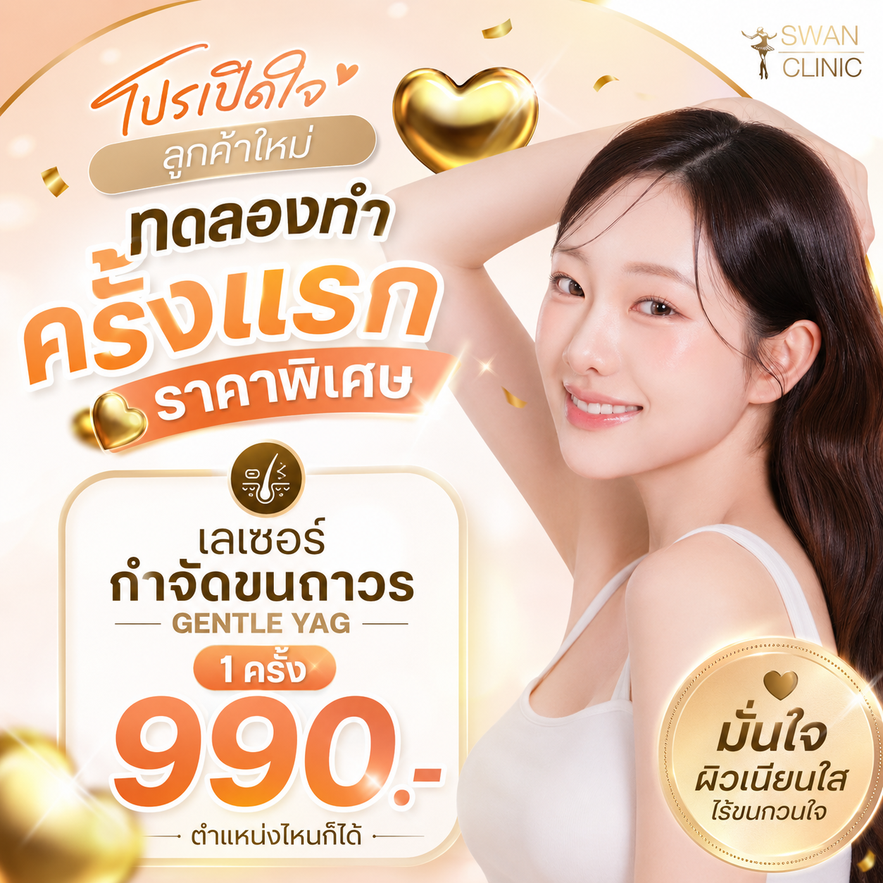 เลเซอร์กำจัดขนถาวร GENTLE YAG