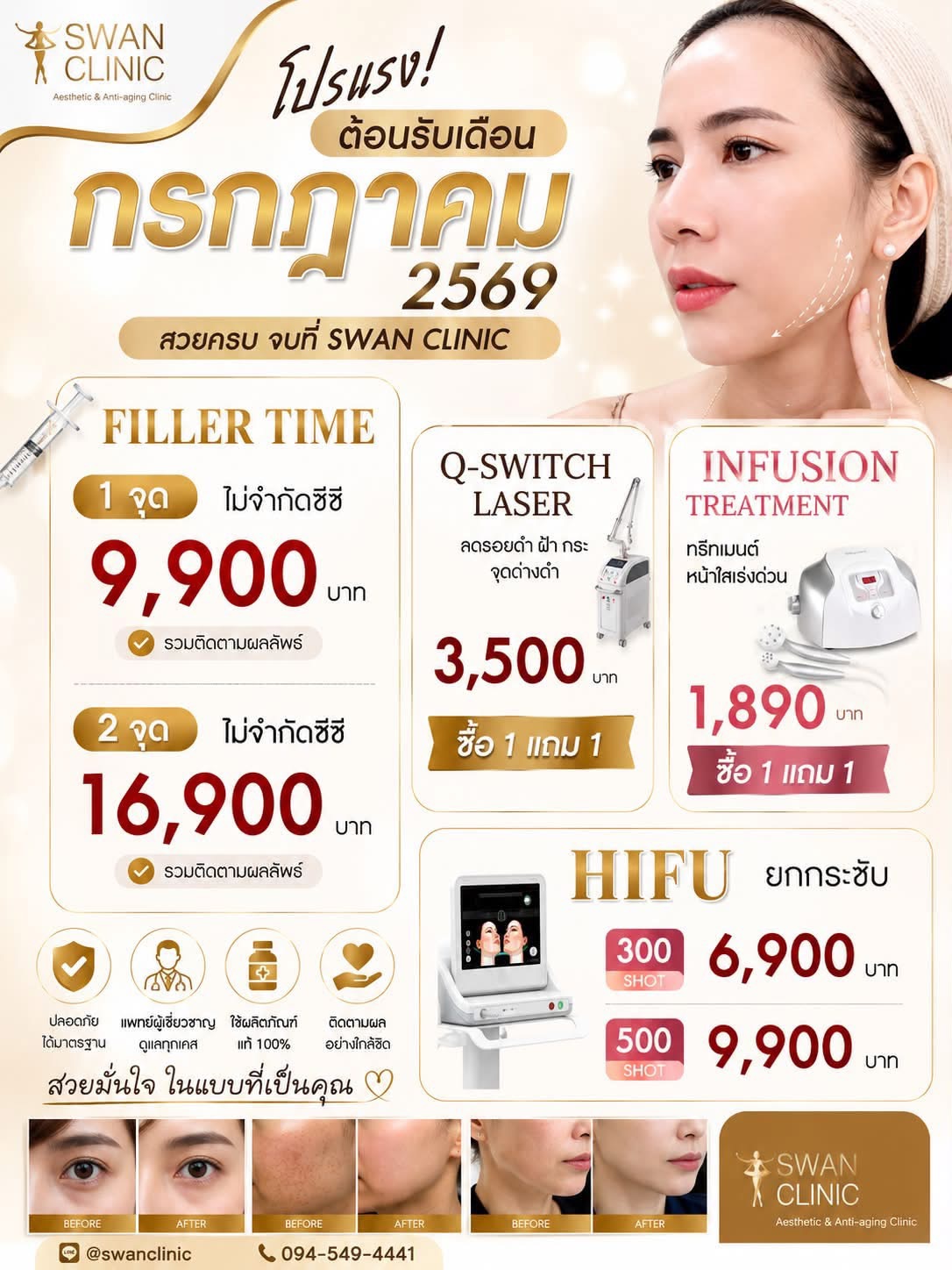 โปรแรง ต้อนรับเดือนกรกฎาคม 2569 สวยครบจบที่ Swan Clinic
