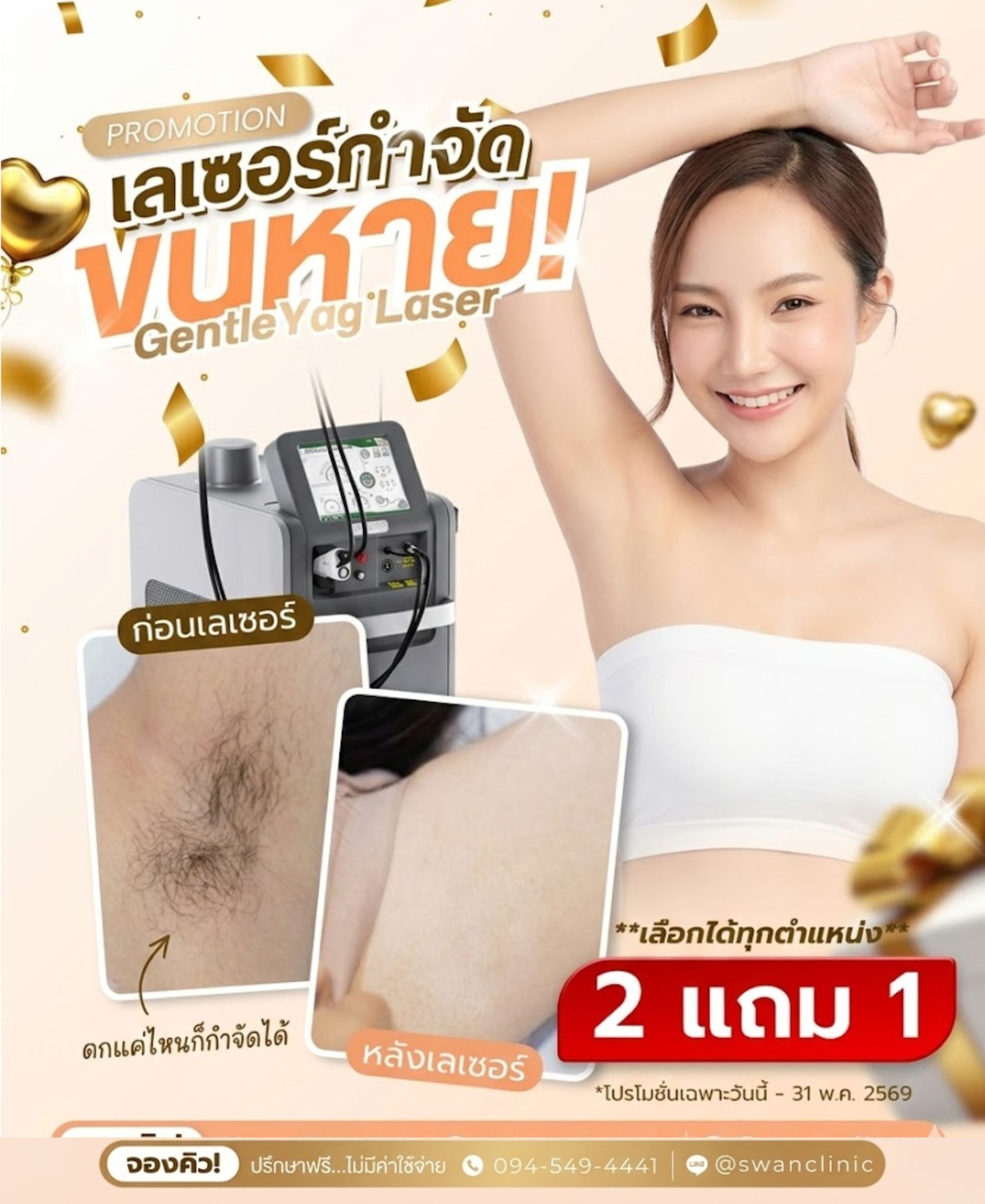 ก่อน-หลังเลเซอร์กำจัดขน